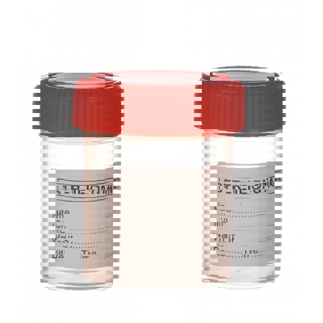 Poza produs Urocultor steril cu eticheta, 60ML, Minut