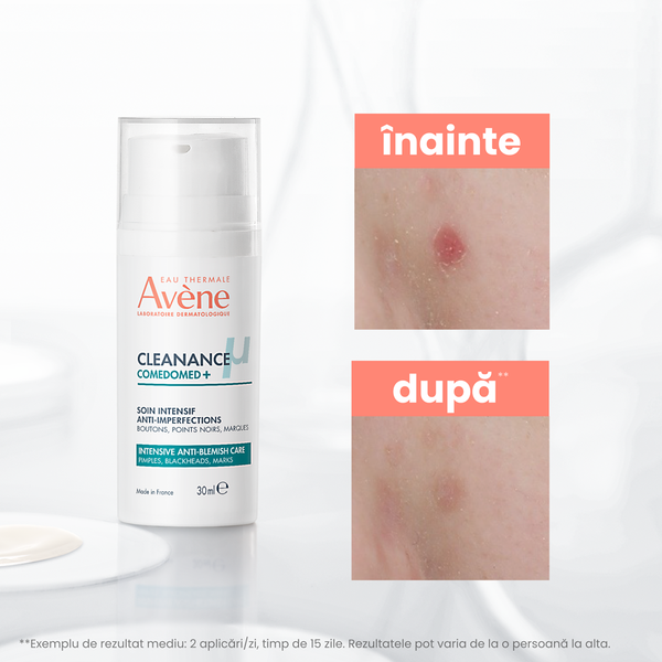 Poza produs Avene Cleanance Comedomed+ concentrat anti-imperfectiuni pentru tenul acneic | 30 ml